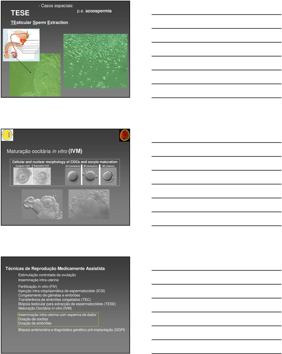 (immature) MI (immature) MII (mature) Técnicas de Reprodução Medicamente Assistida Estimulação controlada da ovulação Inseminação intra-uterina Fertilização in vitro (FIV) Injecção