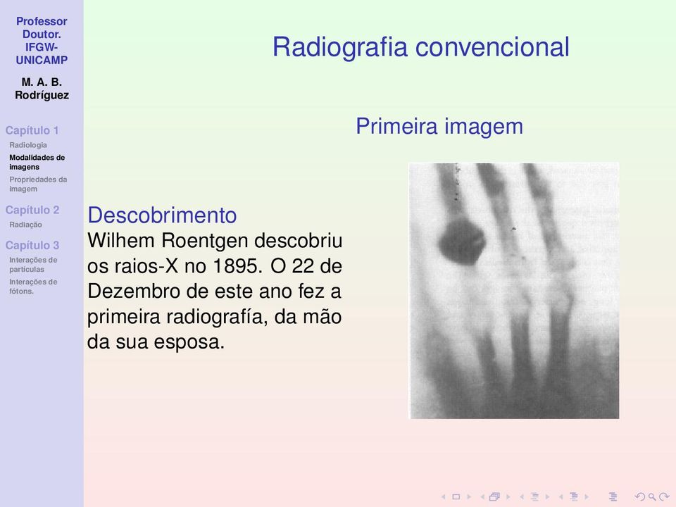 raios-x no 1895.