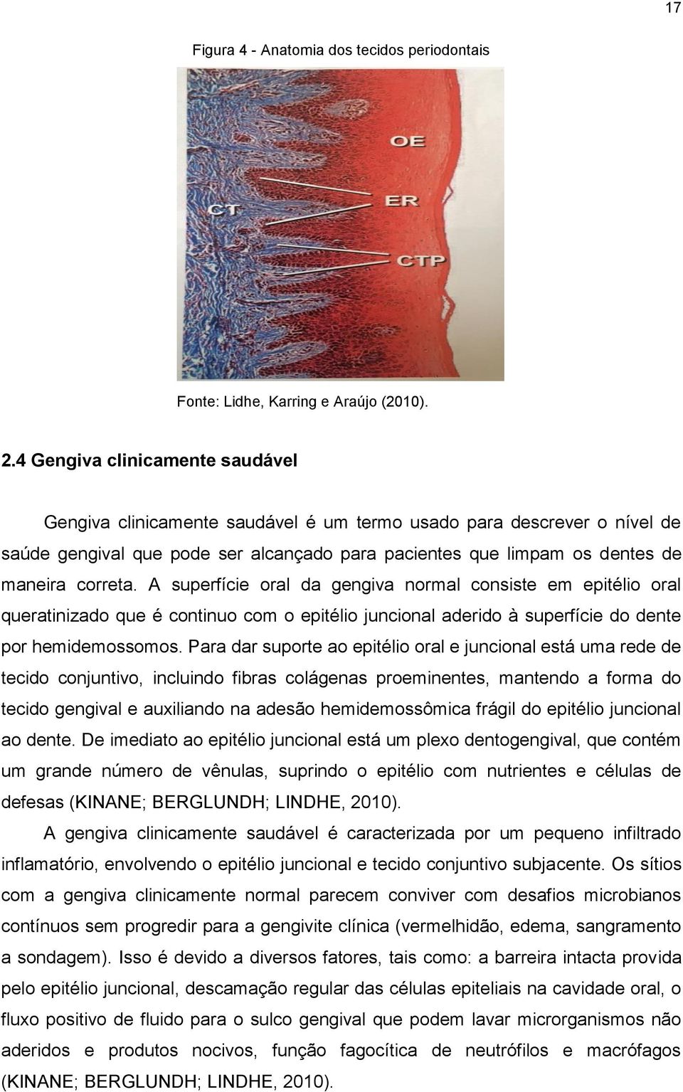 A superfície oral da gengiva normal consiste em epitélio oral queratinizado que é continuo com o epitélio juncional aderido à superfície do dente por hemidemossomos.