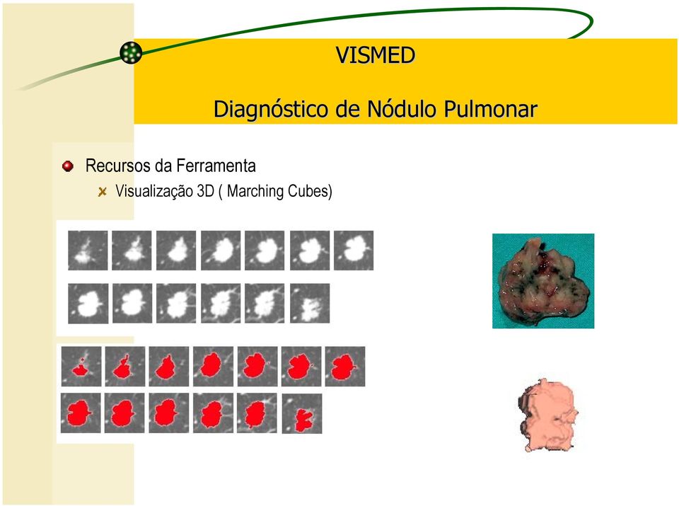 Visualização