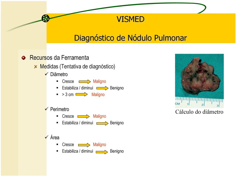 Maligno Perímetro Cresce Maligno Estabiliza / diminui Benigno