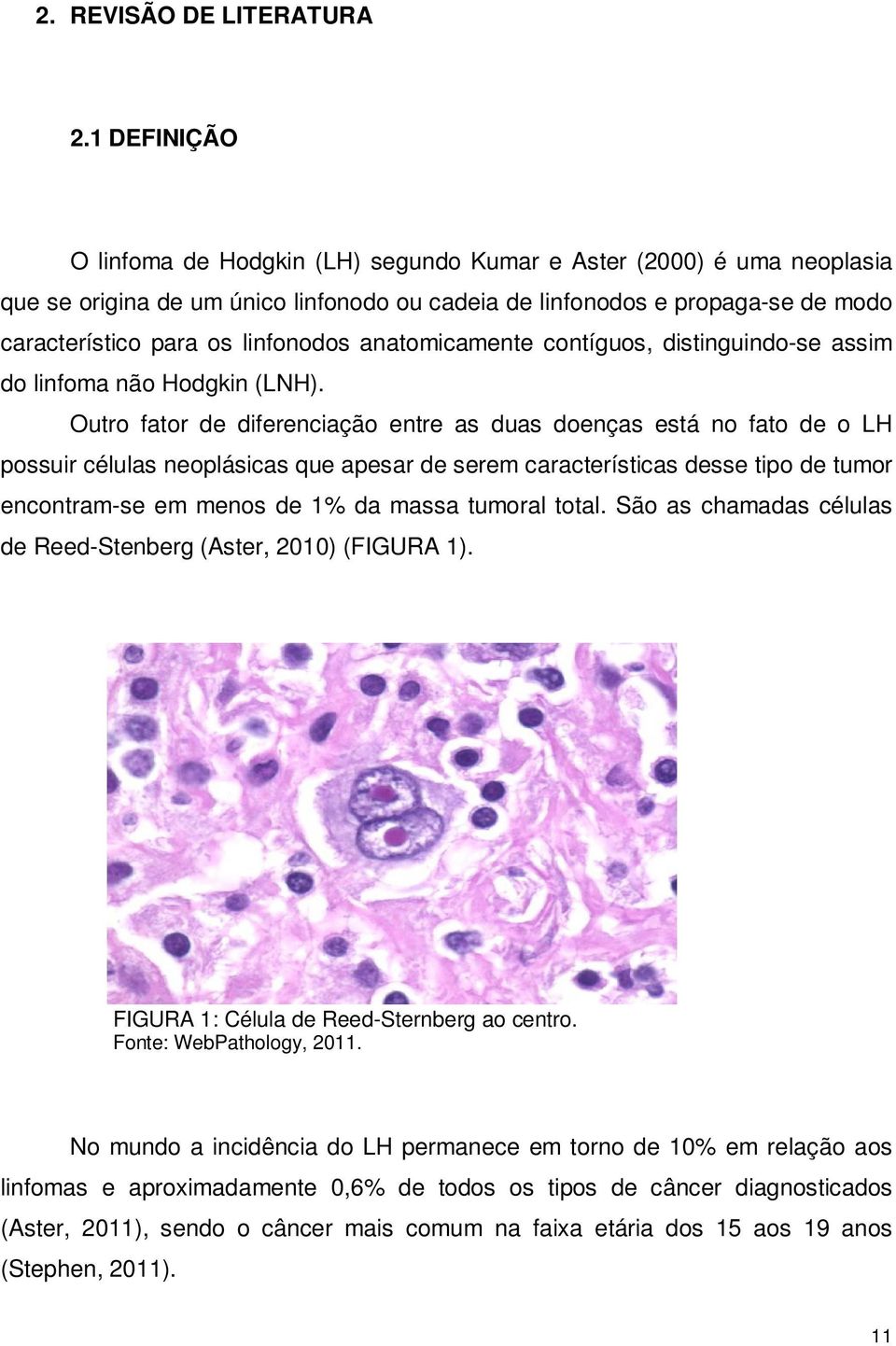 anatomicamente contíguos, distinguindo-se assim do linfoma não Hodgkin (LNH).