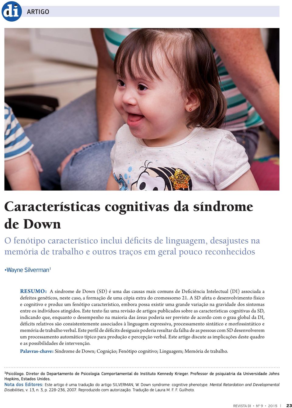 A SD afeta o desenvolvimento físico e cognitivo e produz um fenótipo característico, embora possa existir uma grande variação na gravidade dos sintomas entre os indivíduos atingidos.