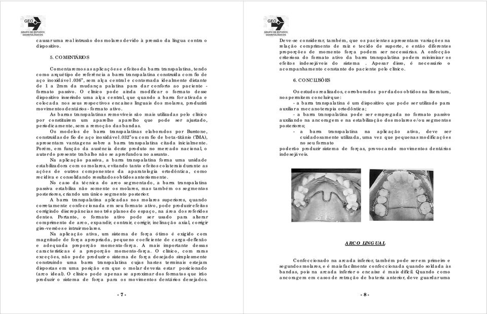 036, sem alça central e contornada idealmente distante de 1 a 2mm da mudança palatina para dar conforto ao paciente - formato passivo.