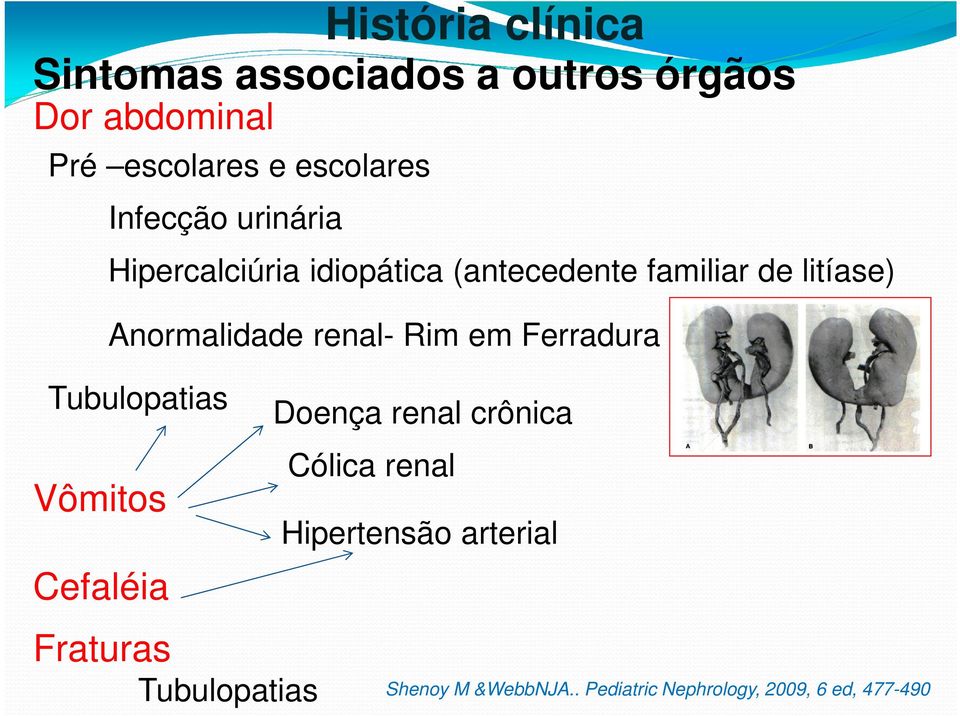 renal- Rim em Ferradura Tubulopatias Vômitos Cefaléia Doença renal crônica Cólica renal