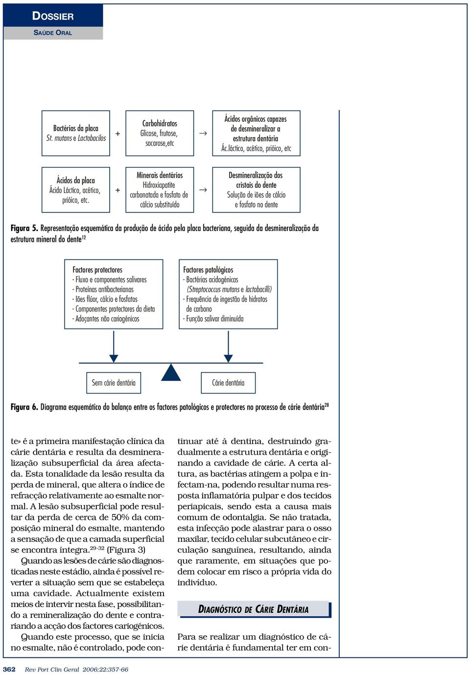 + Minerais dentários Hidroxiapatite carbonatada e fosfato de cálcio substituído Desmineralização dos cristais do dente Solução de iões de cálcio e fosfato no dente Figura 5.