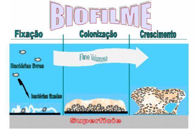 Dificuldade de limpeza: 1.Artigos com lúmen, fundo cego; 2.