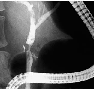 Secções Lesões arteriais iatrogênicas