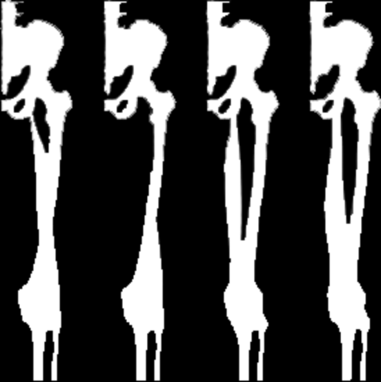 Isquiotibiais Inserções Bíceps Femoral Cabeça Longa: Tuberosidade isquiática e ligamento sacro-tuberoso Cabeça Curta: Lábio lateral da linha áspera Cabeça da fíbula e côndilo lateral da tíbia