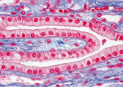 Morfológicas Histologia Humana - Enfermagem Profa.