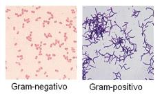 Morfologia Bacteriana O estudo da forma de um organismo, ou de parte dele.