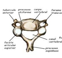 QUAIS SÃO AS DIFERENÇAS ENTRE ARTRITE REUMATÓIDE E OSTEOARTRITE?