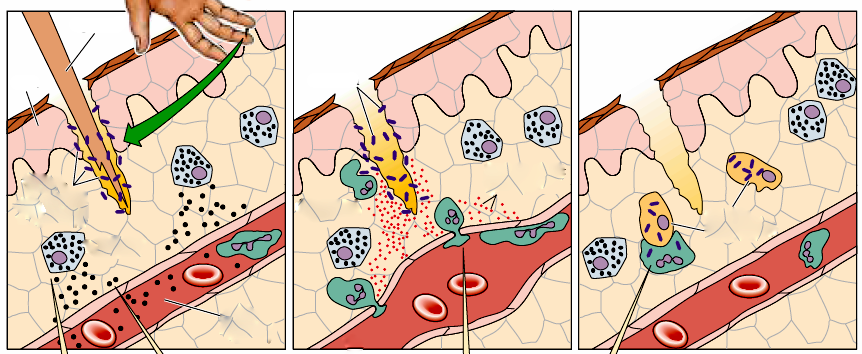 Ação dos fagócitos Pele Farpa Bactérias Neutrófilos e Monócitos migram para o tecido (Diapedese) Bactérias Bactérias mortas Capilar sanguíneo
