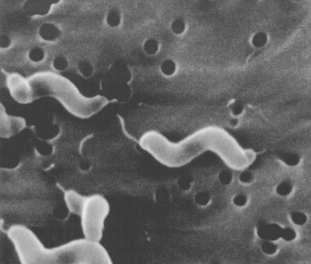 Cocos. Streptococcus sobrinus a crescer na superfície de um dente Vibriões.