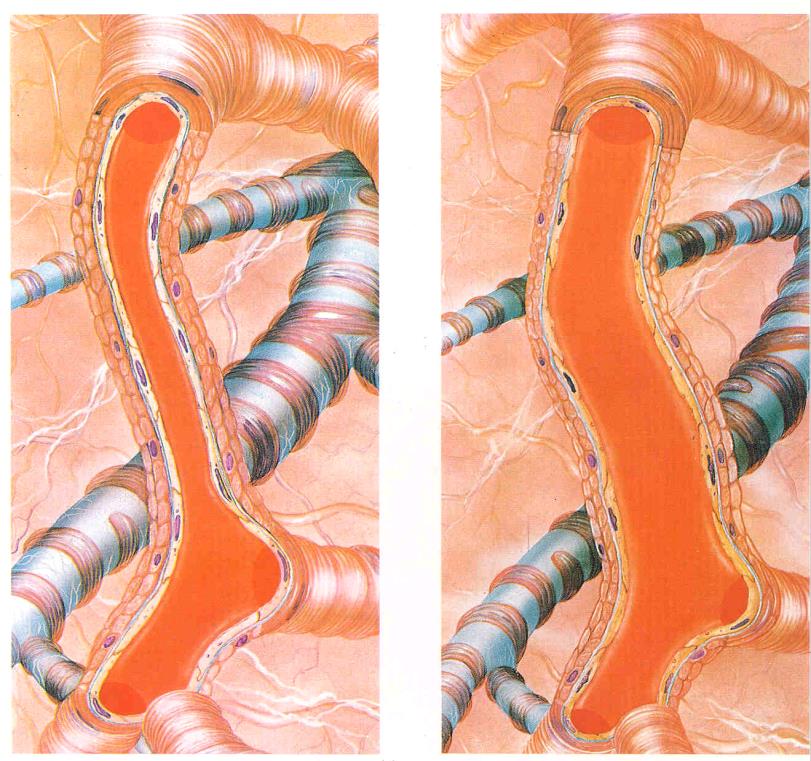 SISTEMA DE RESISTÊNCIA Arteríolas A.