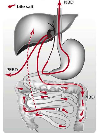 parcial interna conecta VB ao cólon; IB: bypass ileal/anastomose