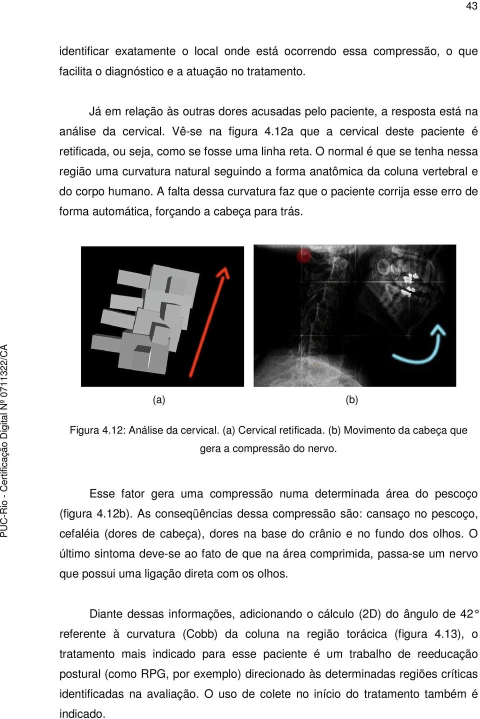 O normal é que se tenha nessa região uma curvatura natural seguindo a forma anatômica da coluna vertebral e do corpo humano.