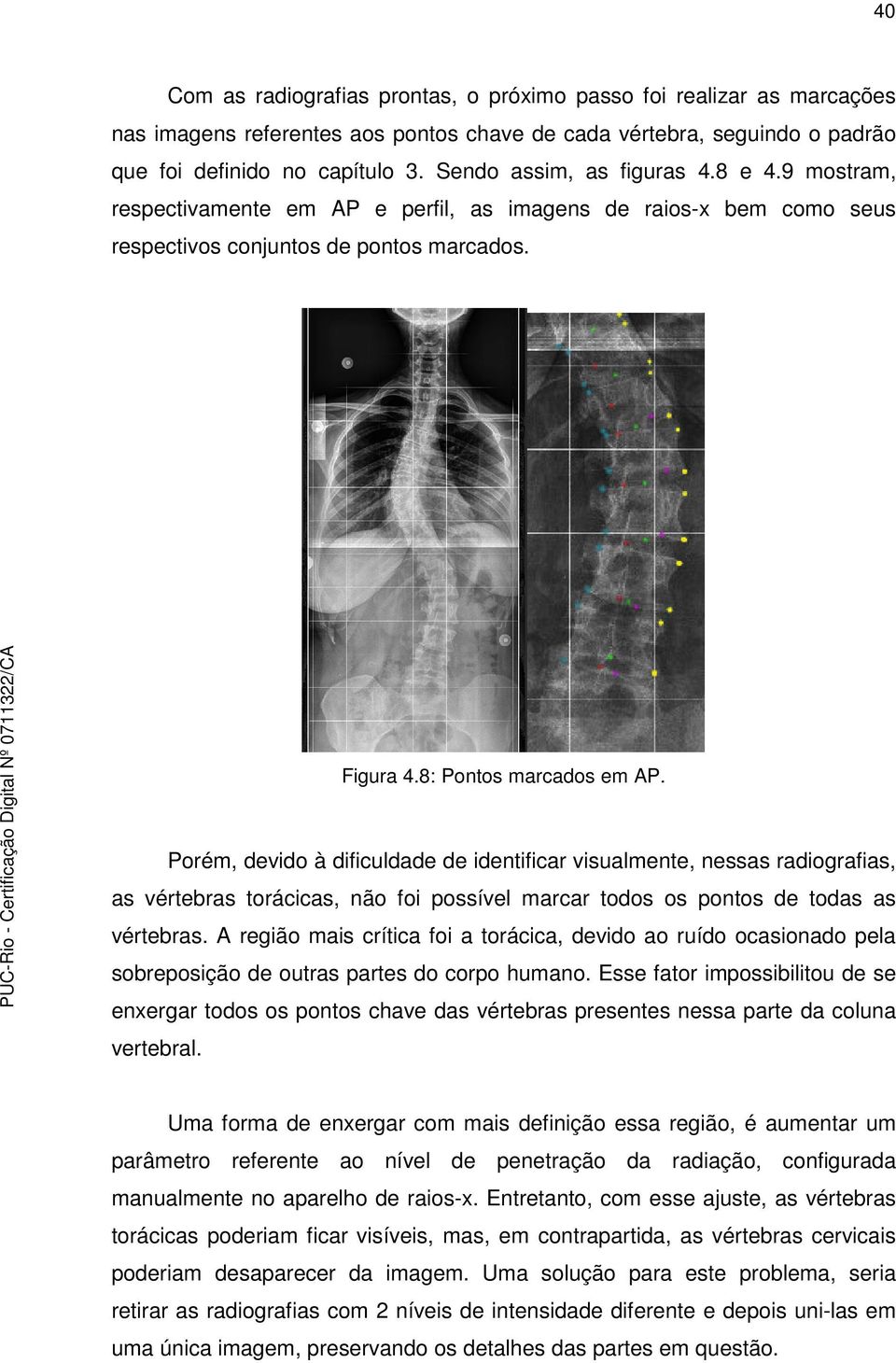 Porém, devido à dificuldade de identificar visualmente, nessas radiografias, as vértebras torácicas, não foi possível marcar todos os pontos de todas as vértebras.