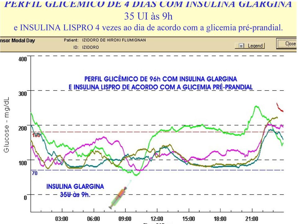 INSULINA LISPRO 4 vezes ao dia