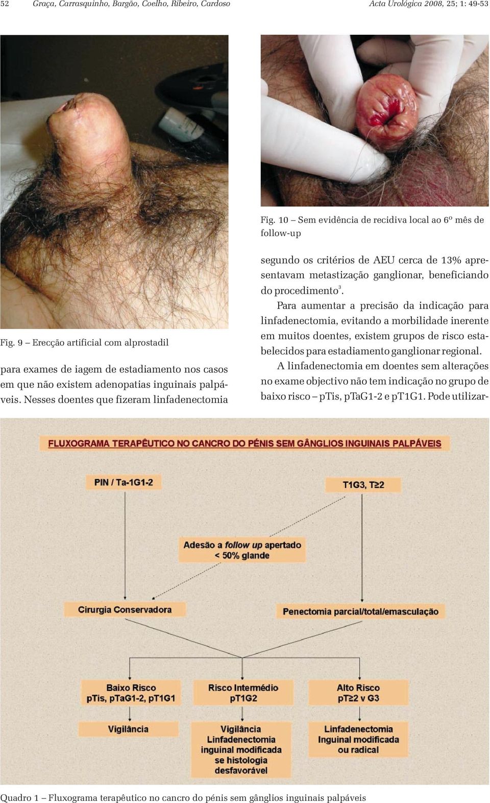 Nesses doentes que fizeram linfadenectomia segundo os critérios de AEU cerca de 3% apresentavam metastização ganglionar, beneficiando do procedimento 3.