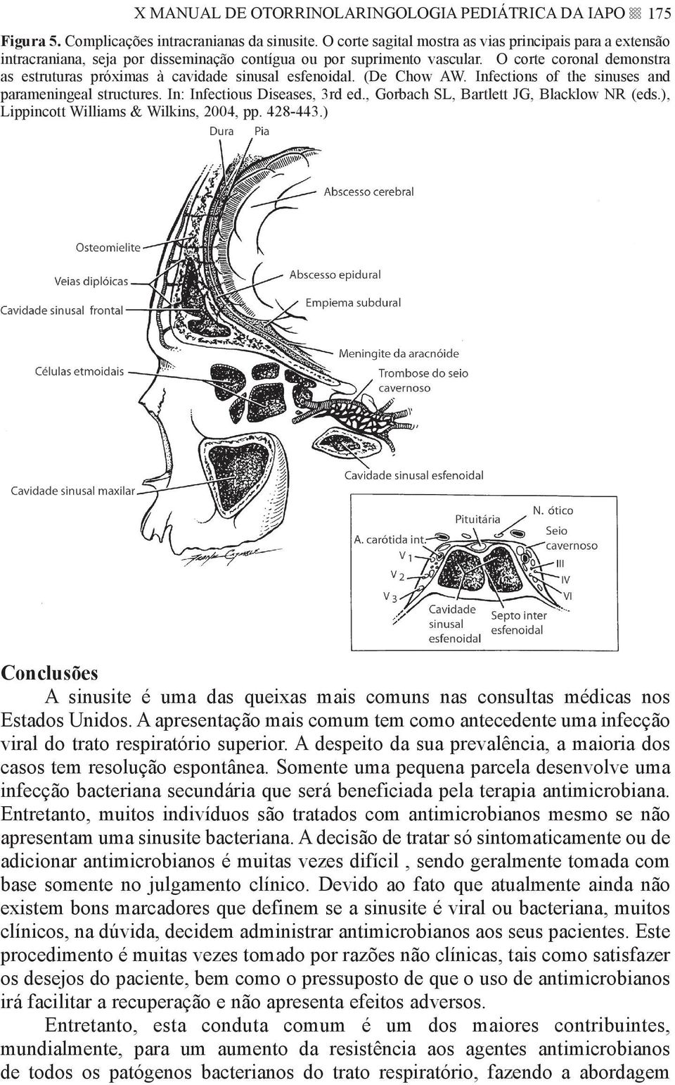 O corte coronal demonstra as estruturas próximas à cavidade sinusal esfenoidal. (De Chow AW. Infections of the sinuses and parameningeal structures. In: Infectious Diseases, 3rd ed.