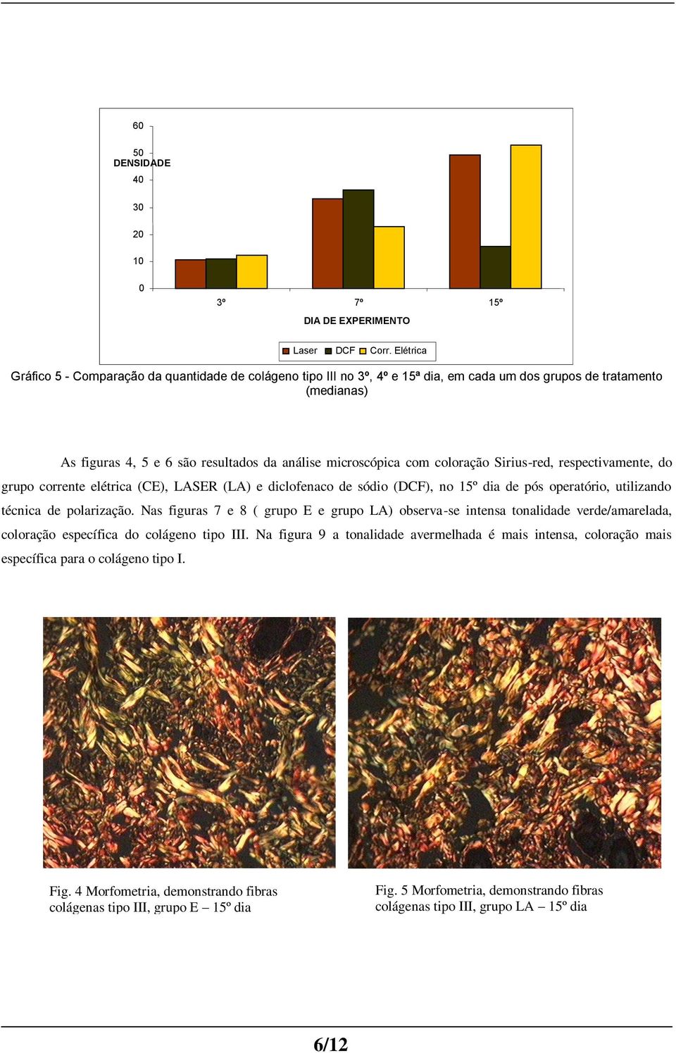 coloração Sirius-red, respectivamente, do grupo corrente elétrica (CE), LASER (LA) e diclofenaco de sódio (DCF), no 15º dia de pós operatório, utilizando técnica de polarização.