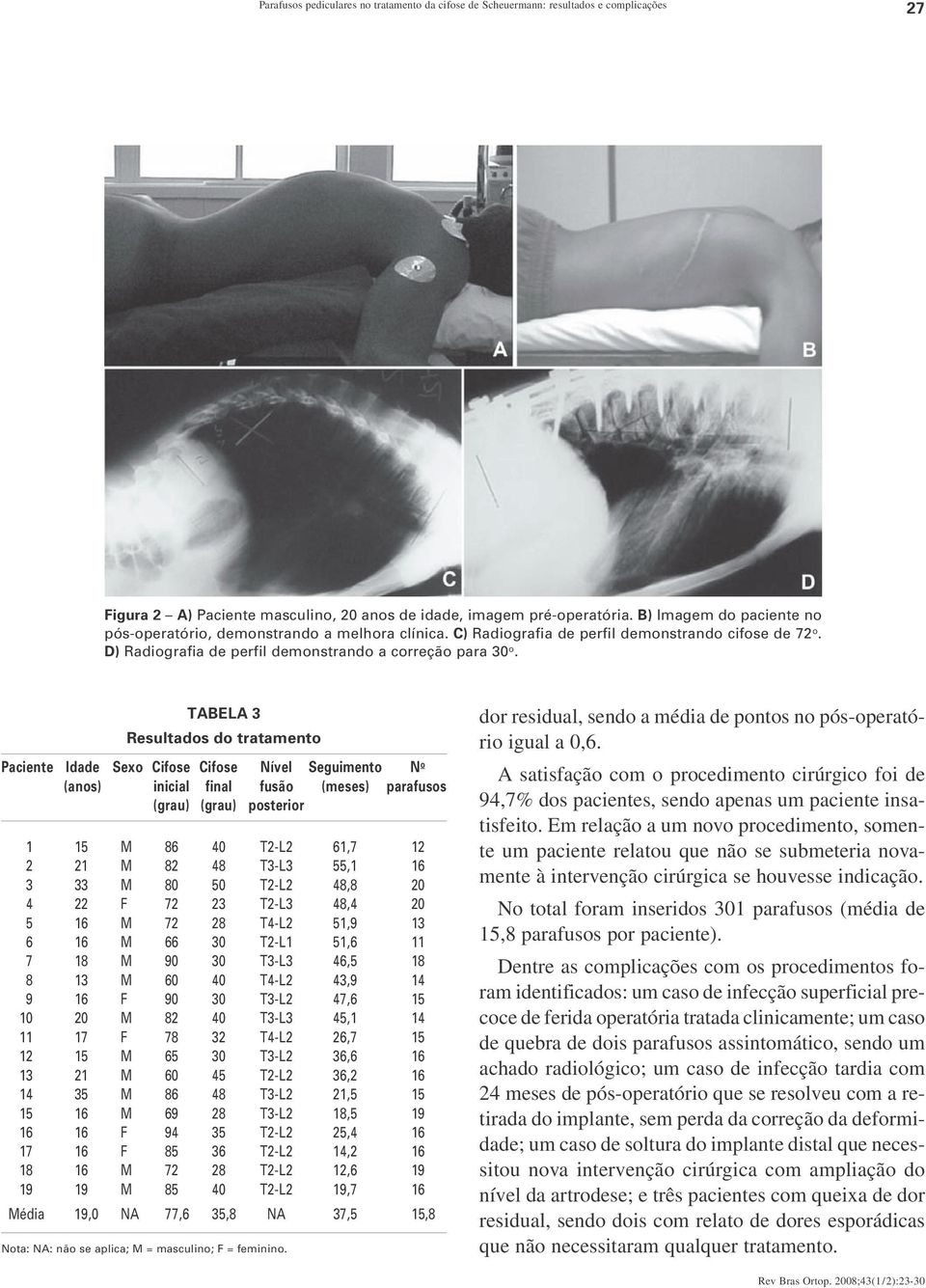 TABELA 3 Resultados do tratamento Paciente Idade Sexo Cifose Cifose Nível Seguimento N o (anos) inicial final fusão (meses) parafusos (grau) (grau) posterior 01 15 M 86 40 T2-L2 61,7 12 02 21 M 82 48