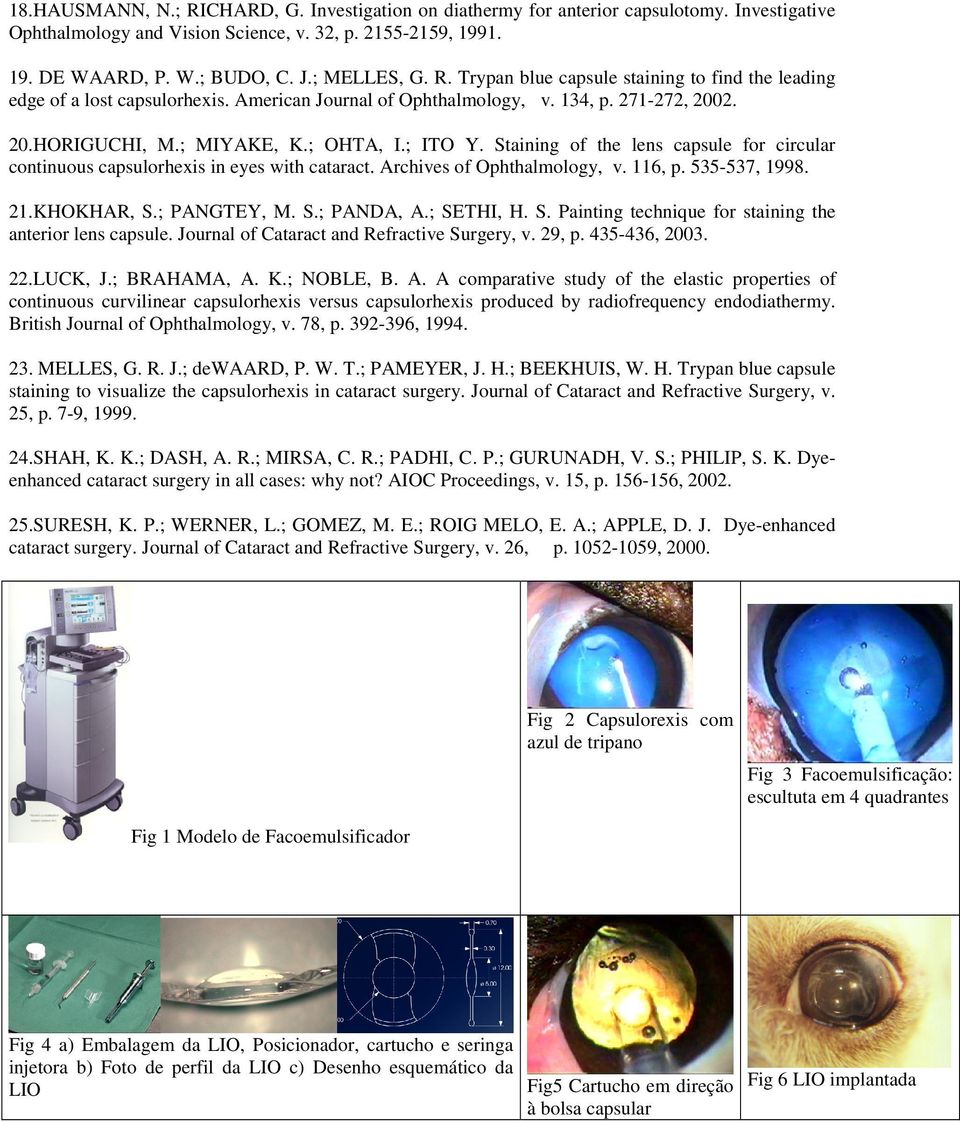 ; ITO Y. Staining of the lens capsule for circular continuous capsulorhexis in eyes with cataract. Archives of Ophthalmology, v. 116, p. 535-537, 1998. 21.KHOKHAR, S.; PANGTEY, M. S.; PANDA, A.