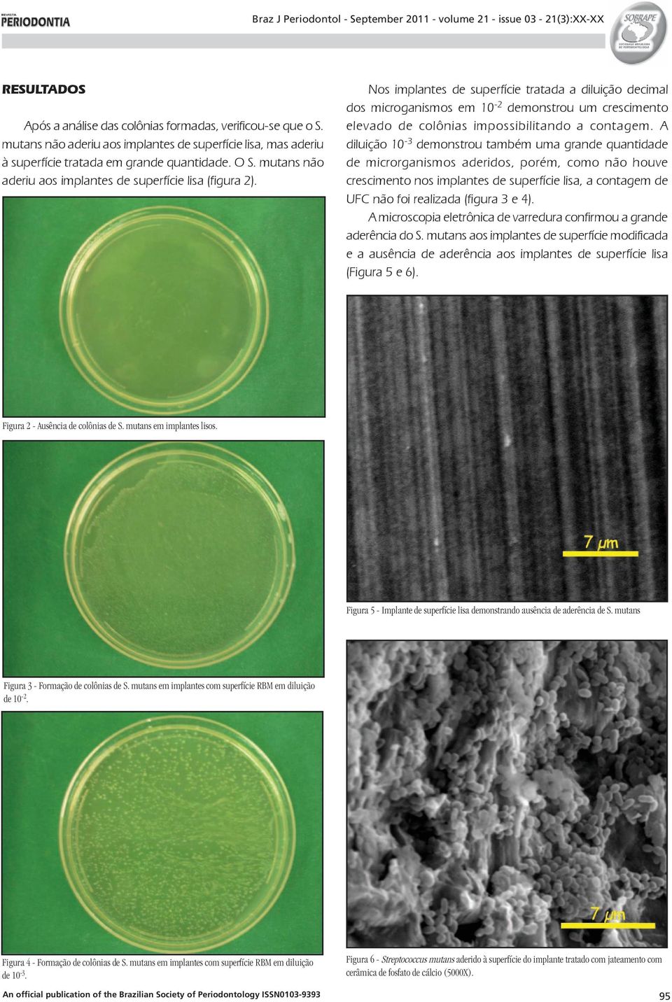 Nos implantes de superfície tratada a diluição decimal dos microganismos em 10-2 demonstrou um crescimento elevado de colônias impossibilitando a contagem.