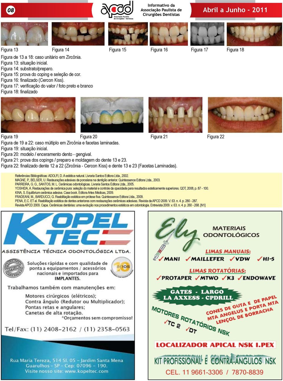 Figura 17: verificação do valor / foto preto e branco Figura 18: finalizado Figura 16 Figura 17 Figura 18 Figura 19 Figura 20 Figura 21 Figura de 19 a 22: caso múltiplo em Zircônia e facetas