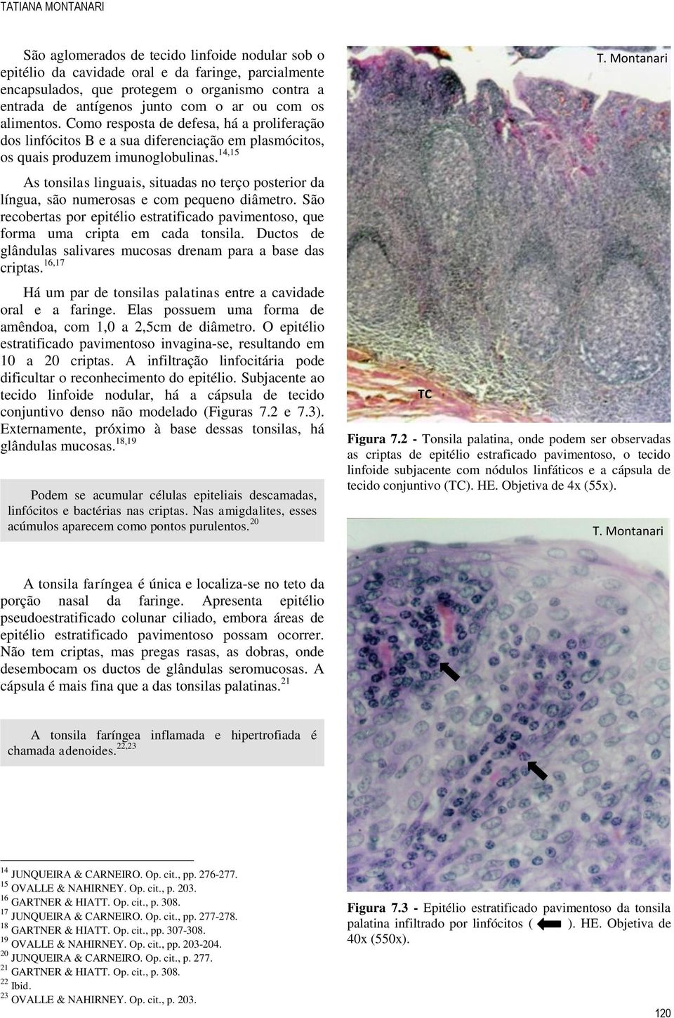 14,15 As tonsilas linguais, situadas no terço posterior da língua, são numerosas e com pequeno diâmetro. São recobertas por epitélio estratificado pavimentoso, que forma uma cripta em cada tonsila.