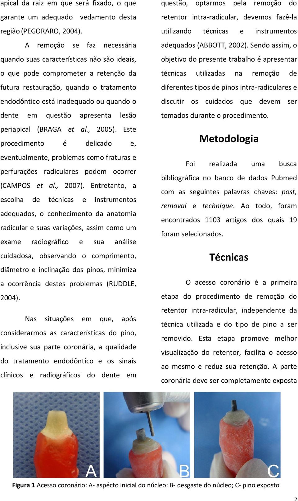 questão apresenta lesão periapical (BRAGA et al., 2005). Este procedimento é delicado e, eventualmente, problemas como fraturas e perfurações radiculares podem ocorrer (CAMPOS et al., 2007).