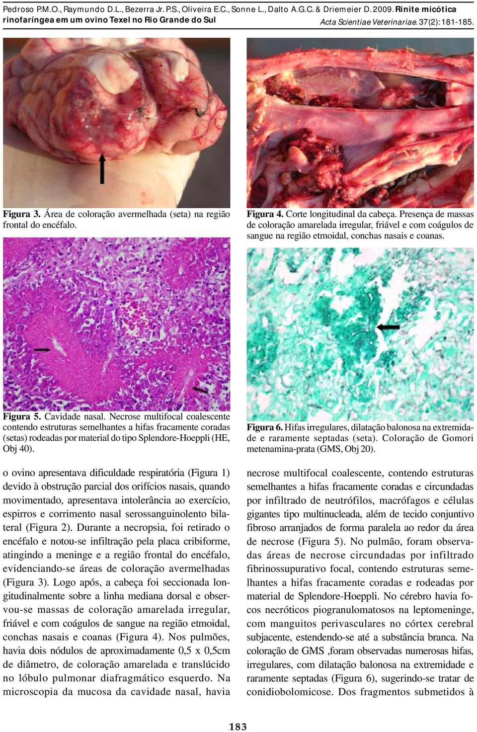 Necrose multifocal coalescente contendo estruturas semelhantes a hifas fracamente coradas (setas) rodeadas por material do tipo Splendore-Hoeppli (HE, Obj 40).