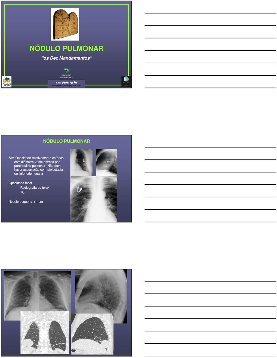 Opacidade relativamente esférica com diâmetro <3cm envolta por parênquima pulmonar.