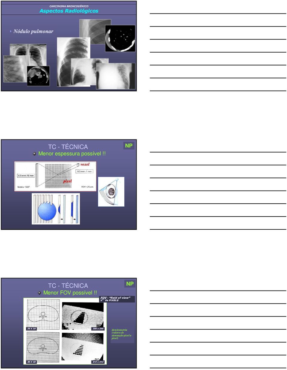 ! NP voxel pixel TC - TÉCNICA Menor FOV possível!