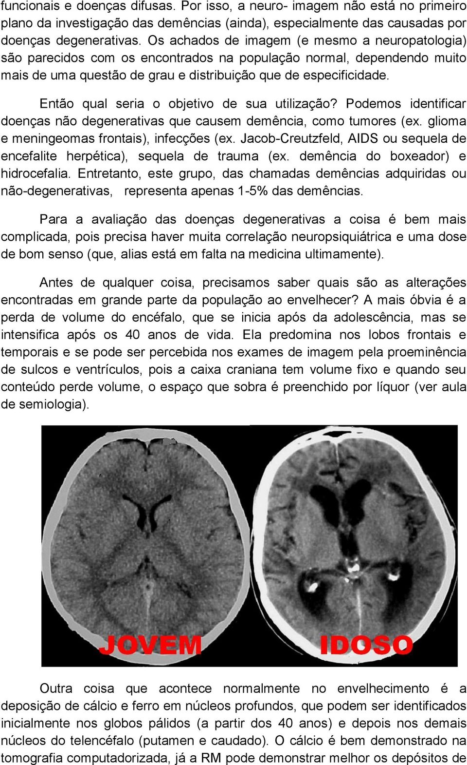 Então qual seria o objetivo de sua utilização? Podemos identificar doenças não degenerativas que causem demência, como tumores (ex. glioma e meningeomas frontais), infecções (ex.