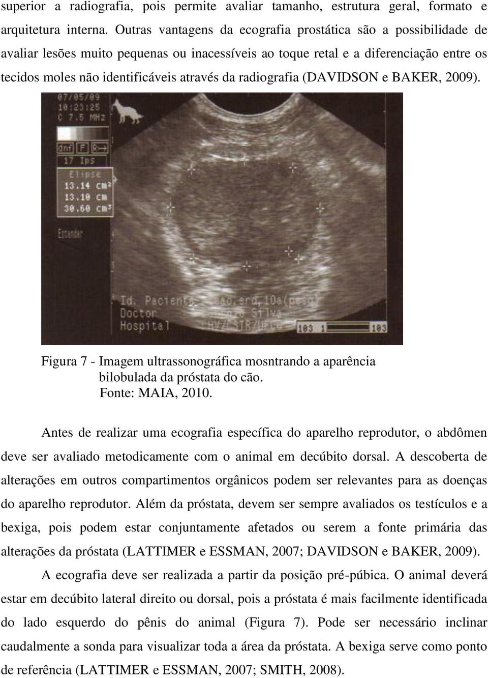 radiografia (DAVIDSON e BAKER, 2009). Figura 7 - Imagem ultrassonográfica mosntrando a aparência bilobulada da próstata do cão. Fonte: MAIA, 2010.