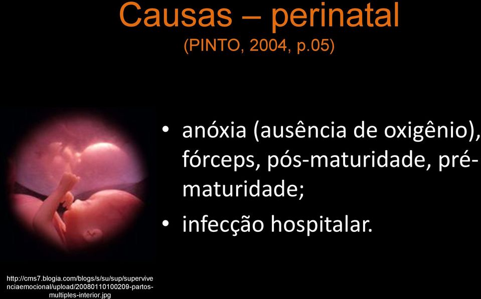 prématuridade; infecção hospitalar. http://cms7.blogia.