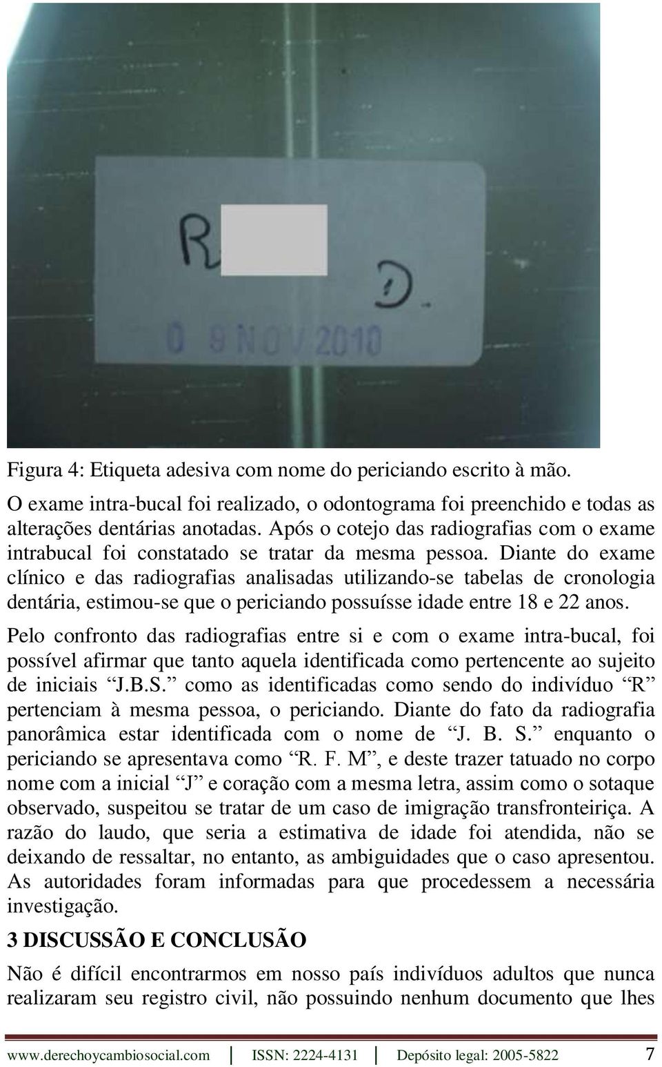 Diante do exame clínico e das radiografias analisadas utilizando-se tabelas de cronologia dentária, estimou-se que o periciando possuísse idade entre 18 e 22 anos.