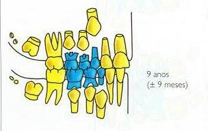 DENTIÇÃO MISTA 54 e 84: Raiz Residual 75 e 85: escore 3 inativo (O) 74: restauração (OD) em ionômero de