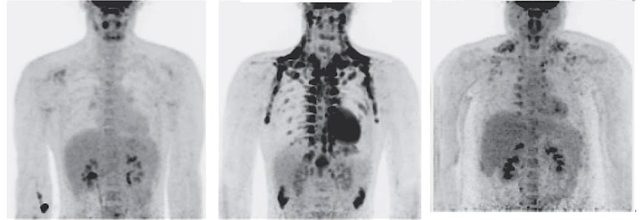 24 Homens saudáveis (IMC: 10 < 25 e 14 > 25) PET-CT