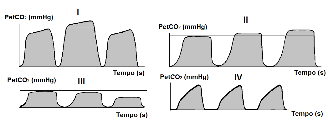 36. Sobre a ação do diafragma, assinale a alternativa INCORRETA.