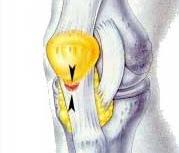 A função principal do poplíteo é destravar a articulação do joelho no início da flexão Influência da posição do tronco no plano sagital estresse patelofemoral Vários músculos que atuam sobre o joelho