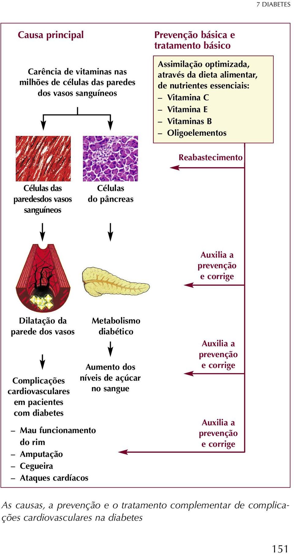 corrige Dilatação da parede dos vasos Complicações cardiovasculares em pacientes com diabetes Mau funcionamento do rim Amputação Cegueira Ataques cardíacos Metabolismo diabético Aumento