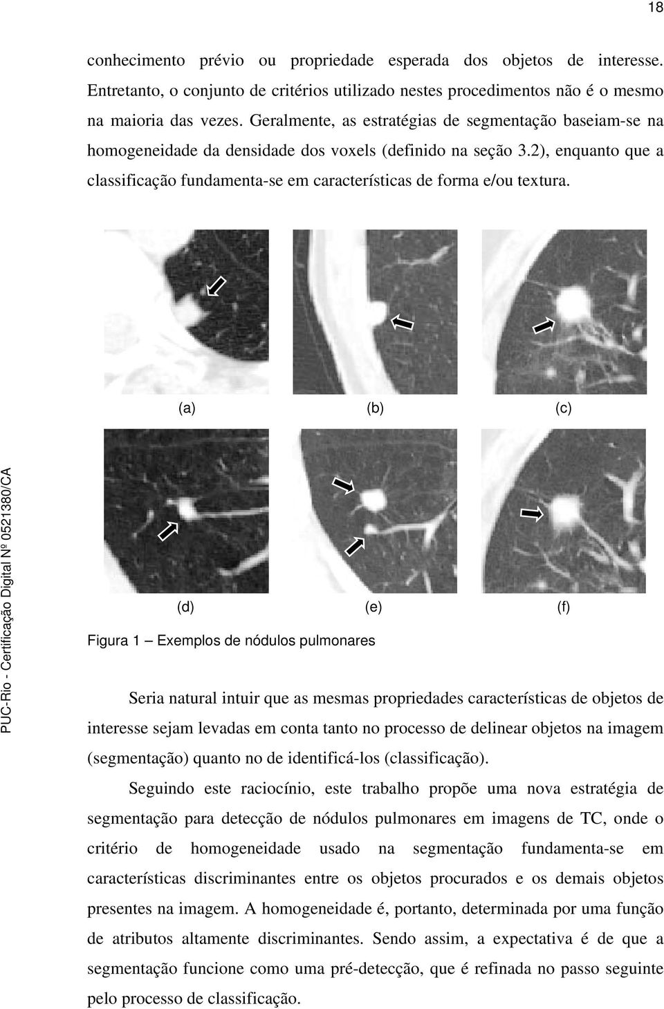 2), enquanto que a classificação fundamenta-se em características de forma e/ou textura.