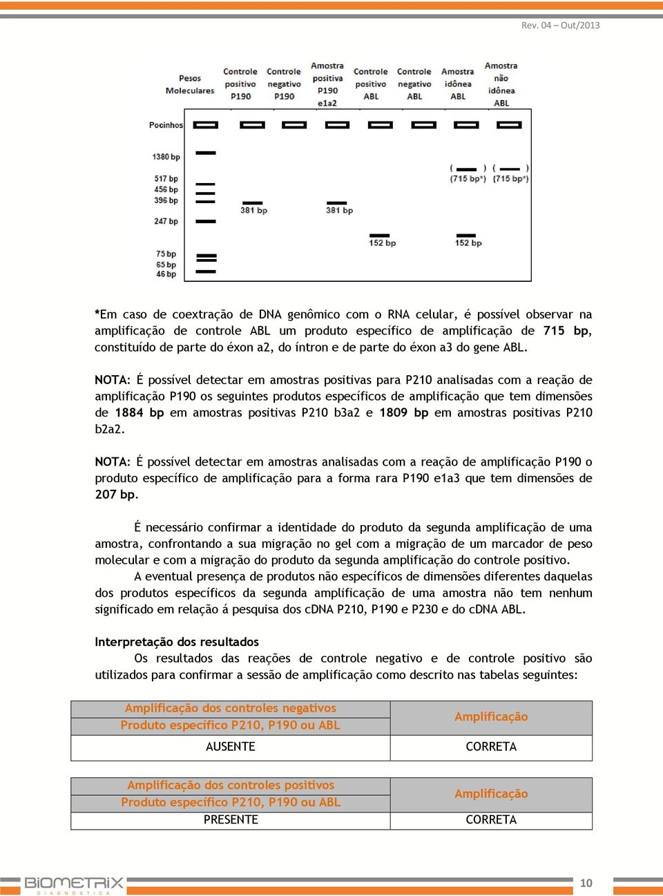 NOTA: É possível detectar em amostras positivas para P210 analisadas com a reação de amplificação P190 os seguintes produtos específicos de amplificação que tem dimensões de 1884 bp em amostras