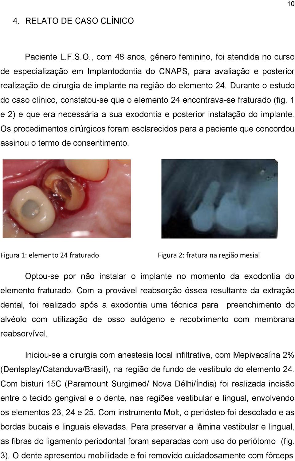 Os procedimentos cirúrgicos foram esclarecidos para a paciente que concordou assinou o termo de consentimento.