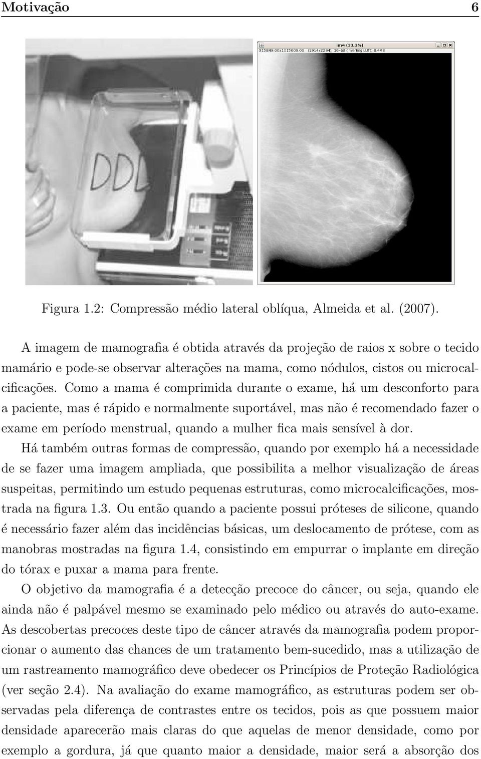 Como a mama é comprimida durante o exame, há um desconforto para a paciente, mas é rápido e normalmente suportável, mas não é recomendado fazer o exame em período menstrual, quando a mulher fica mais