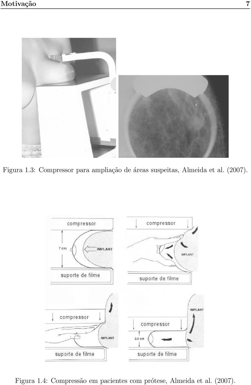 suspeitas, Almeida et al. (2007).