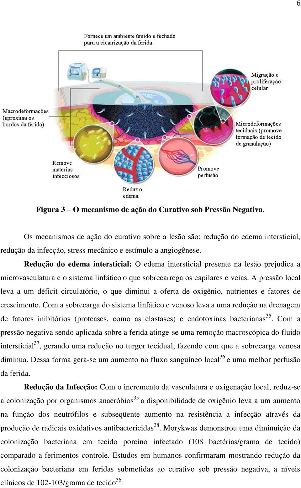 Redução do edema intersticial: O edema intersticial presente na lesão prejudica a microvasculatura e o sistema linfático o que sobrecarrega os capilares e veias.